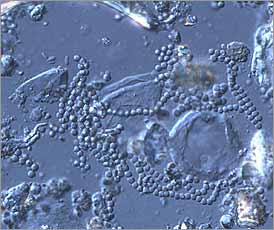 Chains of Penicillium spores found in an air sample